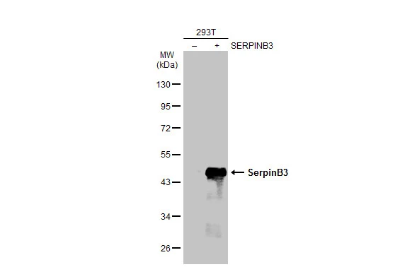 Non-transfected (–) and transfected (+) 293T whole cell extracts (30 μg) were separated by 10% SDS-PAGE, and the membrane was blotted with SerpinB3 antibody [N2C3] (GTX114739) diluted at 1:1000. The HRP-conjugated anti-rabbit IgG antibody (GTX213110-01) was used to detect the primary antibody.