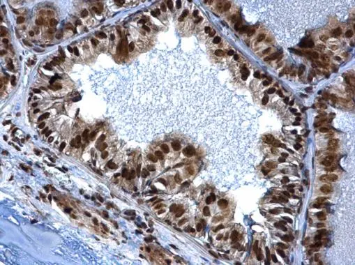 SMARCC1 antibody [C2C3], C-term detects SMARCC1 protein at nucleus on mouse prostate by immunohistochemical analysis. Sample: Paraffin-embedded mouse prostate. SMARCC1 antibody [C2C3], C-term (GTX114777) dilution: 1:500. 
 Antigen Retrieval: Trilogy? (EDTA based, pH 8.0) buffer, 15min