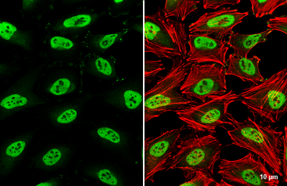 SMARCC1 antibody [C2C3], C-term detects SMARCC1 protein at nucleus by immunofluorescent analysis. Sample: HeLa cells were fixed in 4% paraformaldehyde at RT for 15 min. Green: SMARCC1 stained by SMARCC1 antibody [C2C3], C-term (GTX114777) diluted at 1:500. Red: phalloidin, a cytoskeleton marker, diluted at 1:200. Scale bar= 10 μm.