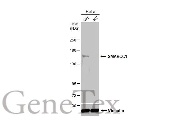 Wild-type (WT) and SMARCC1 knockout (KO) HeLa cell extracts (30 μg) were separated by 5% SDS-PAGE, and the membrane was blotted with SMARCC1 antibody [C2C3], C-term (GTX114777) diluted at 1:4000. The HRP-conjugated anti-rabbit IgG antibody (GTX213110-01) was used to detect the primary antibody.