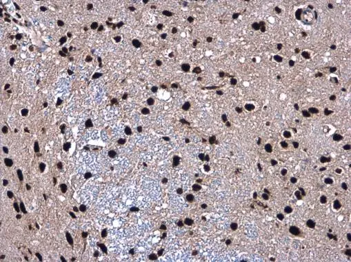 SMARCC2 antibody detects SMARCC2 protein at nucleolus in rat brain by immunohistochemical analysis. Sample: Paraffin-embedded rat brain. SMARCC2 antibody (GTX114778) diluted at 1:500. 
 Antigen Retrieval: Citrate buffer, pH 6.0, 15 min