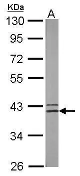 Sample (50 ug of whole cell lysate) A: mouse brain 10% SDS PAGE GTX114783 diluted at 1:500 Sample (50 ug of whole cell lysate) A: mouse brain 10% SDS PAGE GTX114783 diluted at 1:500