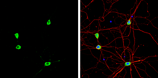 Staufen antibody detects Staufen protein by immunofluorescent analysis. Sample: DIV9 rat E18 primary hippocampal neuron cells were fixed in 4% paraformaldehyde at RT for 15 min. Green: Staufen stained by Staufen antibody (GTX114803) diluted at 1:500. Red: beta Tubulin 3/ Tuj1, stained by beta Tubulin 3/ Tuj1 antibody [GT11710] (GTX631836) diluted at 1:500. Blue: Fluoroshield with DAPI (GTX30920).
