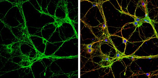 Munc18-1 antibody detects Munc18-1 protein by immunofluorescent analysis. Sample: DIV9 rat E18 primary cortical neurons were fixed in 4% paraformaldehyde at RT for 15 min. Green: Munc18-1 protein stained by Munc18-1 antibody (GTX114809) diluted at 1:500. Red: beta Tubulin 3/ Tuj1, stained by beta Tubulin 3/ Tuj1 antibody [GT886] (GTX631830) diluted at 1:500. Blue: Fluoroshield with DAPI (GTX30920).