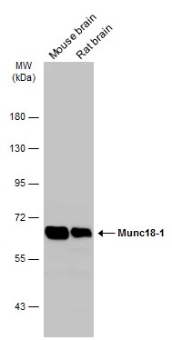 Various tissue extracts (50 μg) were separated by 7.5% SDS-PAGE, and the membrane was blotted with Munc18-1 antibody (GTX114809) diluted at 1:10000. The HRP-conjugated anti-rabbit IgG antibody (GTX213110-01) was used to detect the primary antibody.