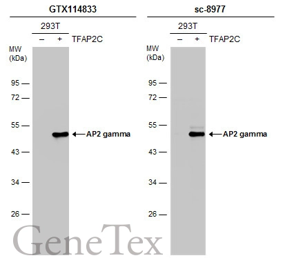 Non-transfected (–) and transfected (+) 293T whole cell extracts (30 μg) were separated by 10% SDS-PAGE, and the membranes were blotted with AP2 gamma antibody [N2C3] (GTX114833) diluted at 1:5000 and competitor's antibody (sc-8977) diluted at 1:1000. The HRP-conjugated anti-rabbit IgG antibody (GTX213110-01) was used to detect the primary antibody.