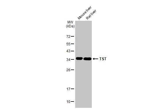 Various tissue extracts (50 μg) were separated by 12% SDS-PAGE, and the membrane was blotted with TST antibody (GTX114858) diluted at 1:1000. The HRP-conjugated anti-rabbit IgG antibody (GTX213110-01) was used to detect the primary antibody.