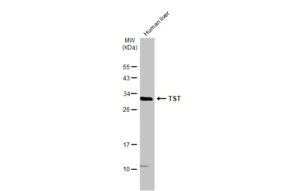 Human tissue extract (50 μg) was separated by 12% SDS-PAGE, and the membrane was blotted with TST antibody (GTX114858) diluted at 1:3000. The HRP-conjugated anti-rabbit IgG antibody (GTX213110-01) was used to detect the primary antibody.