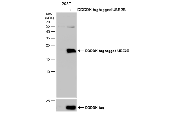 Non-transfected (–) and transfected (+) 293T whole cell extracts (30 μg) were separated by 15% SDS-PAGE, and the membrane was blotted with UBE2B antibody (GTX114867) diluted at 1:1000. The HRP-conjugated anti-rabbit IgG antibody (GTX213110-01) was used to detect the primary antibody.