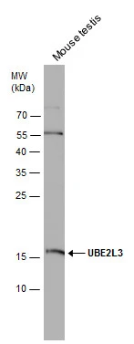 Mouse tissue extract (50 μg) was separated by 15% SDS-PAGE, and the membrane was blotted with UBE2L3 antibody [N1C3] (GTX114870) diluted at 1:1000.