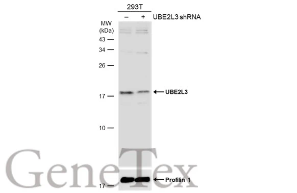 Non-transfected (–) and transfected (+) 293T whole cell extracts (30 μg) were separated by 15% SDS-PAGE, and the membrane was blotted with UBE2L3 antibody [N1C3] (GTX114870) diluted at 1:1000. The HRP-conjugated anti-rabbit IgG antibody (GTX213110-01) was used to detect the primary antibody.