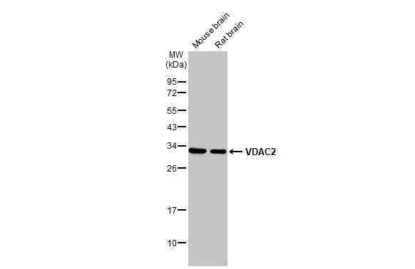 Various tissue extracts (50 μg) were separated by 12% SDS-PAGE, and the membrane was blotted with VDAC2 antibody [N1C2] (GTX114876) diluted at 1:1000. The HRP-conjugated anti-rabbit IgG antibody (GTX213110-01) was used to detect the primary antibody.