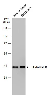 Various tissue extracts (50 μg) were separated by 10% SDS-PAGE, and the membrane was blotted with Aldolase B antibody (GTX114914) diluted at 1:5000. The HRP-conjugated anti-rabbit IgG antibody (GTX213110-01) was used to detect the primary antibody.