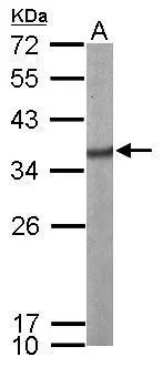 Sample (50 μg of whole cell lysate) A: mouse brain 12% SDS PAGE GTX114918 diluted at 1:1000 The HRP-conjugated anti-rabbit IgG antibody (GTX213110-01) was used to detect the primary antibody.
