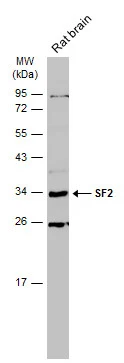 Rat tissue extract (50 μg) was separated by 12% SDS-PAGE, and the membrane was blotted with SF2 antibody (GTX114918) diluted at 1:500. The HRP-conjugated anti-rabbit IgG antibody (GTX213110-01) was used to detect the primary antibody.
