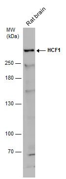 Rat tissue extract (50 μg) was separated by 5% SDS-PAGE, and the membrane was blotted with HCF1 antibody [N1], N-term (GTX114922) diluted at 1:500. The HRP-conjugated anti-rabbit IgG antibody (GTX213110-01) was used to detect the primary antibody.