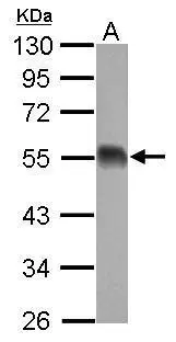 EIF5 antibody detects EIF5 protein by western blot analysis. A. 50 μg mouse brain lysate/extract 10% SDS-PAGE EIF5 antibody (GTX114923) dilution: 1:1000 The HRP-conjugated anti-rabbit IgG antibody (GTX213110-01) was used to detect the primary antibody.