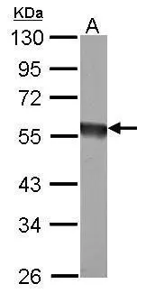 EIF5 antibody detects EIF5 protein by western blot analysis. A. 50 μg rat brain lysate/extract 10% SDS-PAGE EIF5 antibody (GTX114923) dilution: 1:1000 The HRP-conjugated anti-rabbit IgG antibody (GTX213110-01) was used to detect the primary antibody.