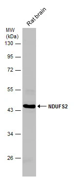 Rat tissue extract (50 μg) was separated by 10% SDS-PAGE, and the membrane was blotted with NDUFS2 antibody (GTX114924) diluted at 1:1000.