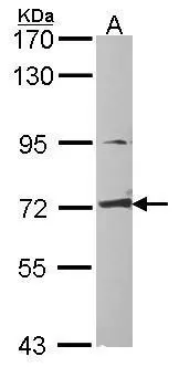 CRMP1 antibody