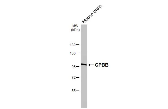 Mouse tissue extract (50 μg) was separated by 7.5% SDS-PAGE, and the membrane was blotted with GPBB antibody [N1N2], N-term (GTX114952) diluted at 1:1000. The HRP-conjugated anti-rabbit IgG antibody (GTX213110-01) was used to detect the primary antibody.