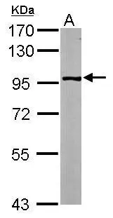 GPBB antibody [N1N2], N-term