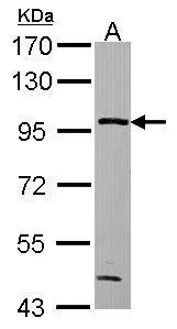 GPBB antibody [N1N2], N-term