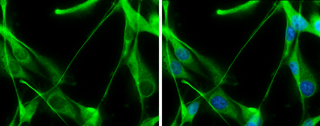 Transaldolase antibody [N2C3] detects Transaldolase protein at cytoplasm by immunofluorescent analysis. Sample: U87-MG cells were fixed in 4% paraformaldehyde at RT for 15 min. Green: Transaldolase stained by Transaldolase antibody [N2C3] (GTX114956) diluted at 1:500. Blue: Hoechst 33342 staining.