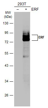 Non-transfected (–) and transfected (+) 293T whole cell extracts (30 μg) were separated by 10% SDS-PAGE, and the membrane was blotted with ERF antibody (GTX114971) diluted at 1:4000. The HRP-conjugated anti-rabbit IgG antibody (GTX213110-01) was used to detect the primary antibody.