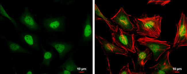 ERF antibody detects ERF protein at nucleus by immunofluorescent analysis. Sample: HeLa cells were fixed in 4% paraformaldehyde at RT for 15 min. Green: ERF stained by ERF antibody (GTX114971) diluted at 1:500. Red: phalloidin, a cytoskeleton marker, diluted at 1:100. Scale bar= 10μm.