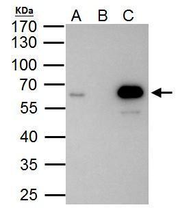 Sample (30 ug of whole cell lysate) A: HepG2 B: HepG2 nucleus 10% SDS PAGE GTX114991 diluted at 1:2000 