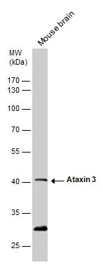 Ataxin 3 antibody detects Ataxin 3 protein by western blot analysis. Mouse tissue extracts (50 μg) was separated by 10% SDS-PAGE, and blotted with Ataxin 3 antibody (GTX115032) diluted by 1:500. The HRP-conjugated anti-rabbit IgG antibody (GTX213110-01) was used to detect the primary antibody.