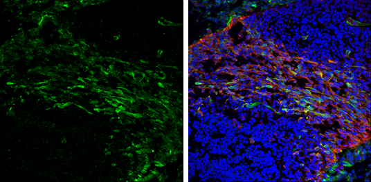 Visinin-like 1 antibody detects Visinin-like 1 protein expression by immunohistochemical analysis. Sample: Frozen sectioned E13.5 Rat brain. Green: Visinin-like 1 protein stained by Visinin-like 1 antibody (GTX115039) diluted at 1:250. Red: beta Tubulin 3/ TUJ1, a mature neuron marker, stained by beta Tubulin 3/ TUJ1 antibody [GT11710] (GTX631836) diluted at 1:500. Blue: Fluoroshield with DAPI (GTX30920).