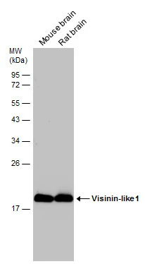 Various tissue extracts (50 μg) were separated by 12% SDS-PAGE, and the membrane was blotted with Visinin-like 1 antibody (GTX115039) diluted at 1:100000.