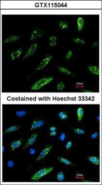 An ELISA plate is coated with 50 uL of a DDDDK Tag conjugated BSA at concentration of 5 ug/mL. The peptide conjugated carrier protein is coated and detected with anti-DDDDK Tag antibody (GTX115044) at concentration ranged from 3.1 to 200 ng/mL.