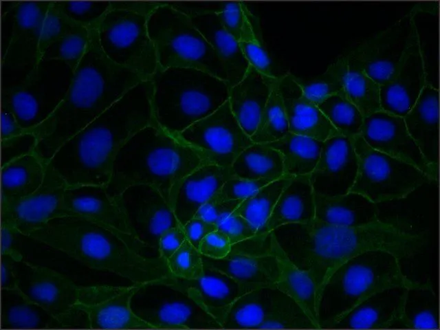 ICC/IF analysis of MDCK cells using GTX11506 gamma Catenin antibody [15F11] at 1:500 (green) with DAPI (blue). Cells were fixed and permeabilized with 4% PFA followed by 0.5% Triton X-100.
