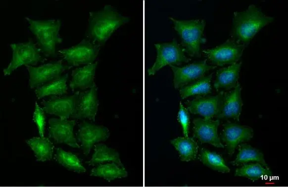 STAM antibody [N2C2], Internal detects STAM protein at cytoplasm by immunofluorescent analysis. Sample: HeLa cells were fixed in 4% paraformaldehyde at RT for 15 min. Green: STAM stained by STAM antibody [N2C2], Internal (GTX115060) diluted at 1:500. Blue: Fluoroshield with DAPI (GTX30920).