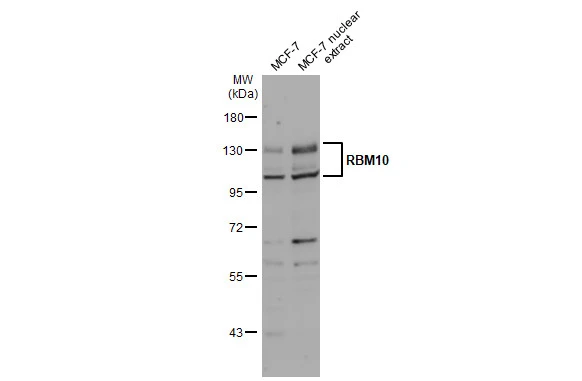 MCF-7 whole cell and nuclear extracts (30 μg) were separated by 7.5% SDS-PAGE, and the membrane was blotted with RBM10 antibody (GTX115074) diluted at 1:1000. The HRP-conjugated anti-rabbit IgG antibody (GTX213110-01) was used to detect the primary antibody.
