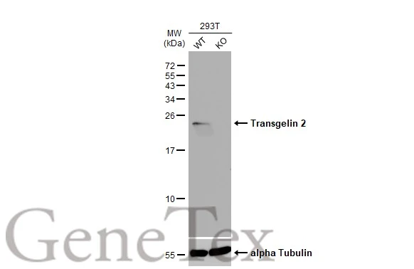 Wild-type (WT) and Transgelin 2 knockout (KO) 293T cell extracts (30 μg) were separated by 15% SDS-PAGE, and the membrane was blotted with Transgelin 2 antibody [N1C3] (GTX115082) diluted at 1:1000. The HRP-conjugated anti-rabbit IgG antibody (GTX213110-01) was used to detect the primary antibody.