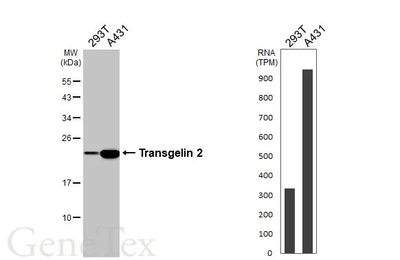 Various whole cell extracts (30 μg) were separated by 12% SDS-PAGE, and the membrane was blotted with Transgelin 2 antibody [N1C3] (GTX115082) diluted at 1:1000. The HRP-conjugated anti-rabbit IgG antibody (GTX213110-01) was used to detect the primary antibody. Corresponding RNA expression data for the same cell lines are based on Human Protein Atlas program.