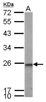 Sample (50 μg of whole cell lysate) A: mouse brain 12% SDS PAGE GTX115082 diluted at 1:1000 The HRP-conjugated anti-rabbit IgG antibody (GTX213110-01) was used to detect the primary antibody.