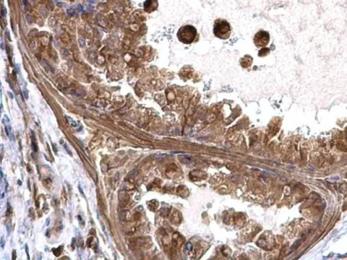 Transgelin 2 antibody [N1C3] detects Transgelin 2 protein at cytoplasm in mouse prostate by immunohistochemical analysis. Sample: Paraffin-embedded mouse prostate. Transgelin 2 antibody [N1C3] (GTX115082) diluted at 1:500. 
 Antigen Retrieval: Trilogy? (EDTA based, pH 8.0) buffer, 15min