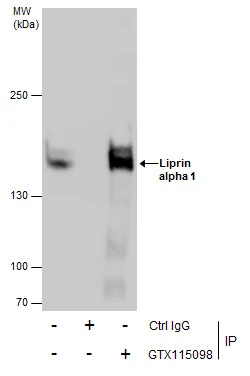 Liprin alpha 1 antibody [N1N2],N-term detects Liprin alpha 1 protein by immunofluorescent analysis.