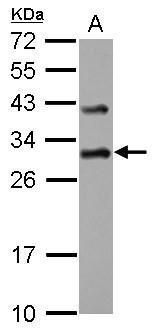 Immunohistochemical analysis of paraffin-embedded mouse muscle,using DENR(GTX115106) antibody at 1:500 dilution. Antigen Retrieval: Trilogy? (EDTA based,pH 8.0) buffer,15min