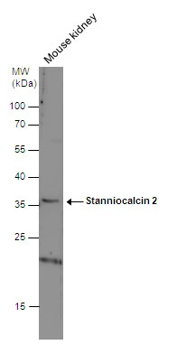 Stanniocalcin 2 antibody detects Stanniocalcin 2 protein by western blot analysis. Mouse tissue extracts (50 μg) was separated by 12% SDS-PAGE, and the membrane was blotted with Stanniocalcin 2 antibody (GTX115113) diluted at 1:1000. Stanniocalcin 2 antibody detects Stanniocalcin 2 protein by western blot analysis. Mouse tissue extracts (50 μg) was separated by 12% SDS-PAGE, and the membrane was blotted with Stanniocalcin 2 antibody (GTX115113) diluted at 1:1000.