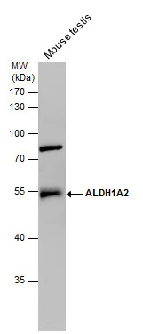 ALDH1A2 antibody detects ALDH1A2 protein by Western blot analysis. Mouse tissue extracts (50 μg) was separated by 10 % SDS-PAGE, and the membrane was blotted with ALDH1A2 antibody (GTX115147) diluted by 1:1000.