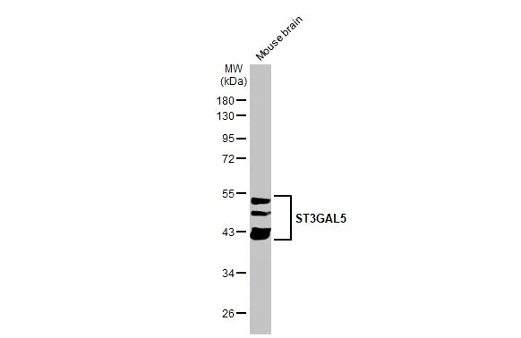 Mouse tissue extract (50 μg) was separated by 10% SDS-PAGE, and the membrane was blotted with ST3GAL5 antibody [N3C3] (GTX115152) diluted at 1:1000. The HRP-conjugated anti-rabbit IgG antibody (GTX213110-01) was used to detect the primary antibody.