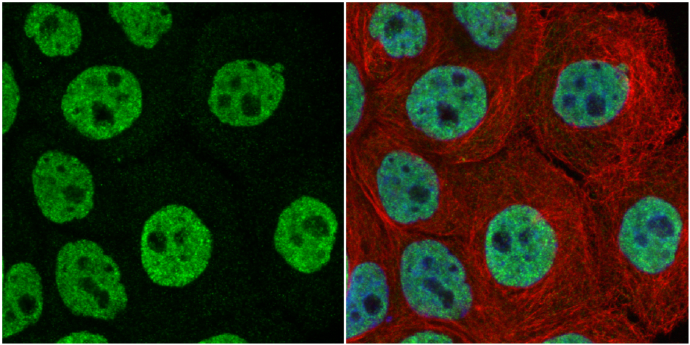 FUBP1 antibody detects FUBP1 protein at nucleus by immunofluorescent analysis. Sample: A431 cells were fixed in 4% paraformaldehyde at RT for 15 min. Green: FUBP1 protein stained by FUBP1 antibody (GTX115154) diluted at 1:1000. Red: alpha Tubulin, a cytoskeleton marker, stained by alpha Tubulin antibody [GT114] (GTX628802) diluted at 1:1000. Blue: Hoechst 33342 staining.