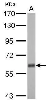 USP14 antibody detects USP14 protein by Western blot analysis. A. 50 μg rat brain lysate/extract 7.5 % SDS-PAGE USP14 antibody (GTX115186) dilution: 1:1000