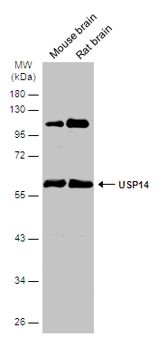 Various tissue extracts (50 μg) were separated by 10% SDS-PAGE, and the membrane was blotted with USP14 antibody (GTX115187) diluted at 1:1000. The HRP-conjugated anti-rabbit IgG antibody (GTX213110-01) was used to detect the primary antibody.